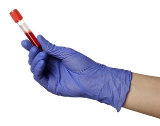 Photo of Doctor in medical glove holding test tube with blood sample on white background, closeup