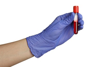 Photo of Doctor in medical glove holding test tube with blood sample on white background, closeup