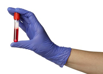 Photo of Doctor in medical glove holding test tube with blood sample on white background, closeup