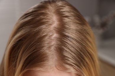 Photo of Woman with undying hair roots on blurred background, closeup