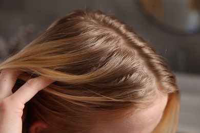 Photo of Woman with undying hair roots on blurred background, closeup