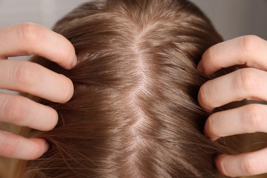 Photo of Woman with undying hair roots on blurred background, closeup