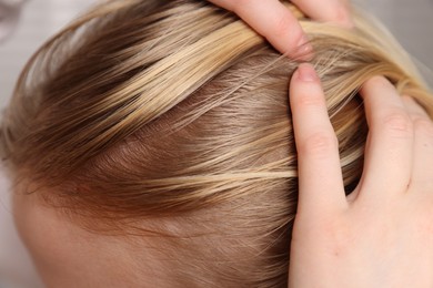 Photo of Woman with undying hair roots on blurred background, closeup