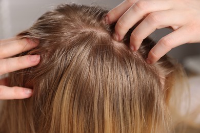 Photo of Woman with undying hair roots on blurred background, closeup