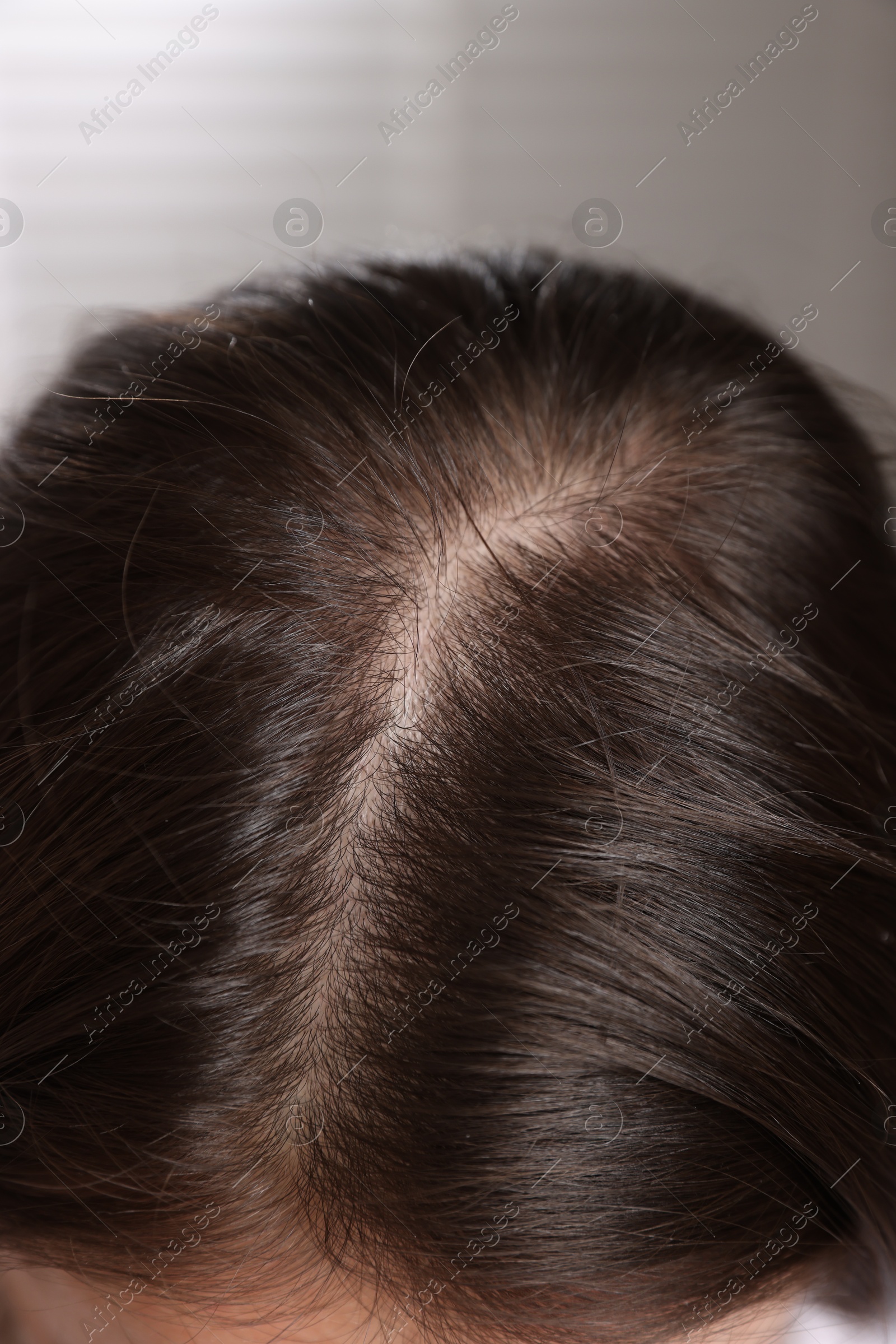 Photo of Woman with healthy hair roots on blurred background, closeup