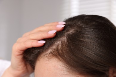 Woman with healthy hair roots on blurred background, closeup