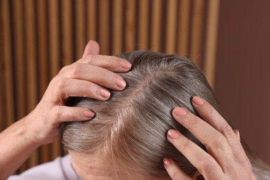 Photo of Senior woman with healthy hair roots on blurred background, closeup