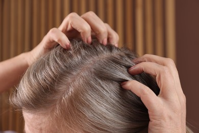 Photo of Senior woman with healthy hair roots on blurred background, closeup