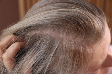 Senior woman with healthy hair roots on blurred background, closeup