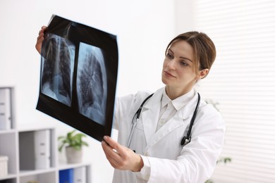 Photo of Doctor examining x-ray of lungs in hospital