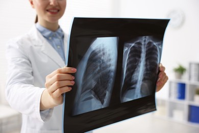 Photo of Doctor examining lungs x-ray in hospital, closeup