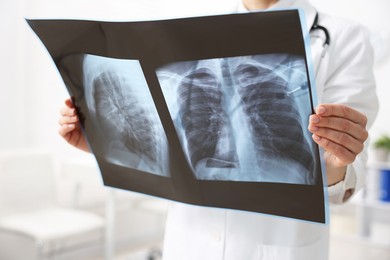 Photo of Doctor examining lungs x-ray in hospital, closeup