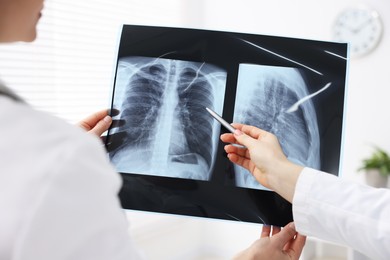 Photo of Doctors examining lungs x-ray in hospital, closeup