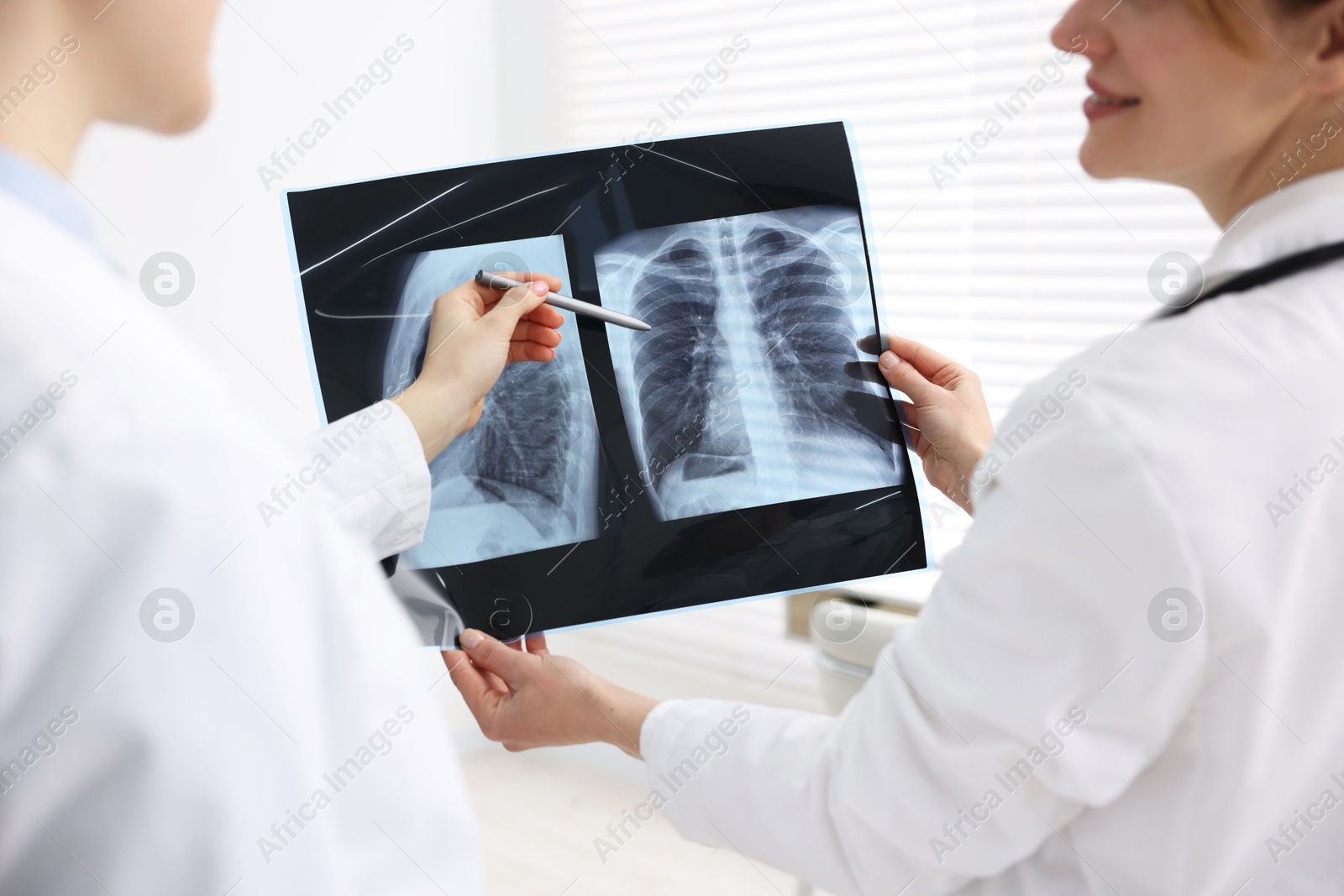 Photo of Doctors examining lungs x-ray in hospital, closeup