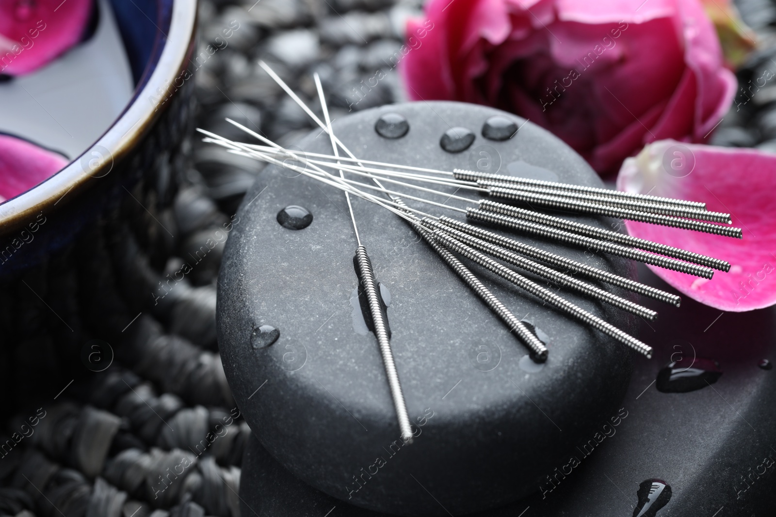 Acupuncture needles, wet spa stones and flowers on wicker mat, closeup Photo of Acupuncture needles, wet spa stones and flowers on wicker mat, closeup