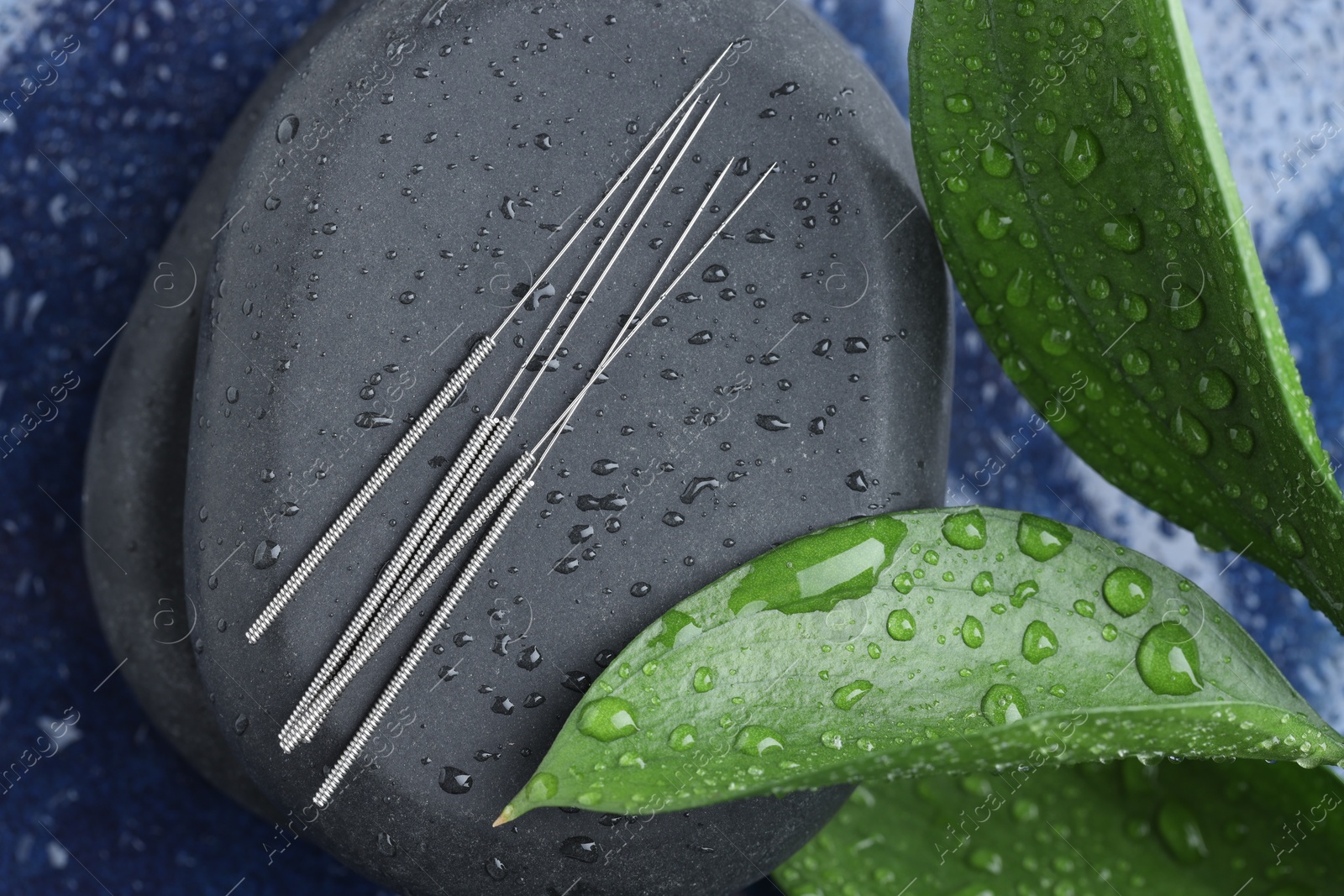 Acupuncture needles, wet spa stones and leaves on blue tray, top view Photo of Acupuncture needles, wet spa stones and leaves on blue tray, top view