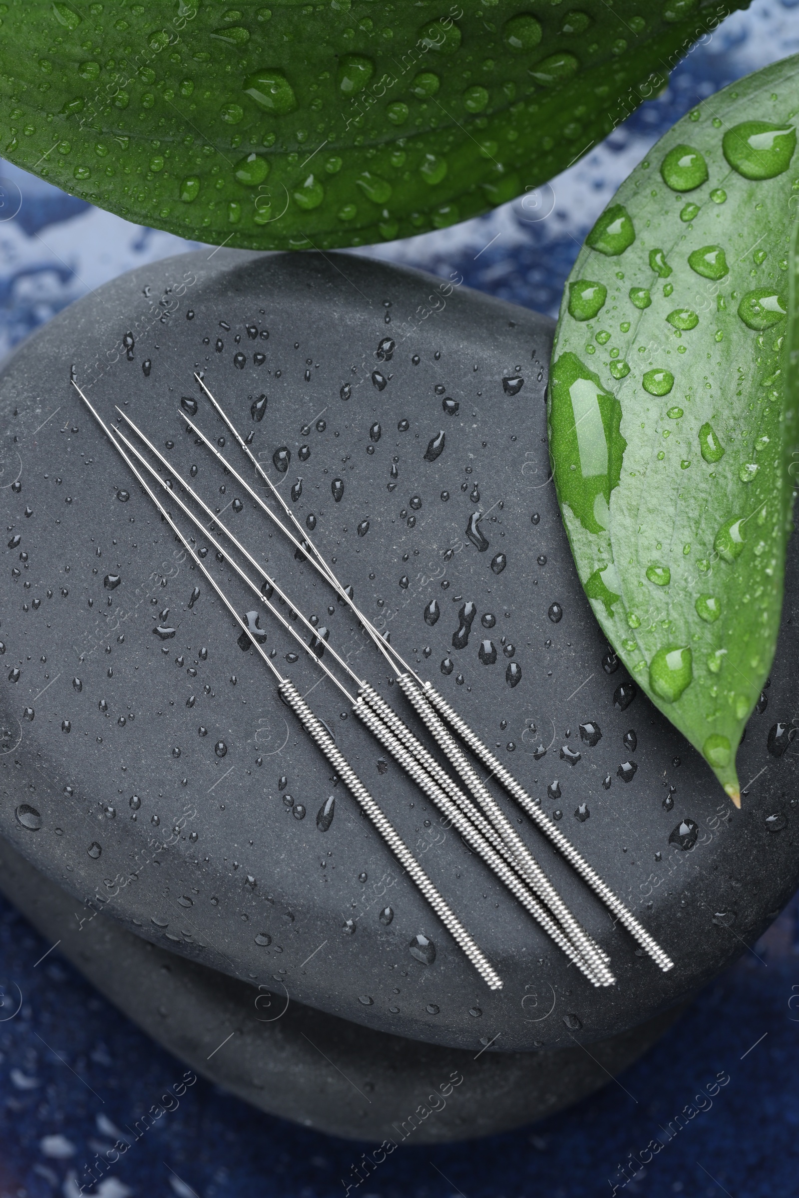 Acupuncture needles, wet spa stones and leaves on blue tray, closeup Photo of Acupuncture needles, wet spa stones and leaves on blue tray, closeup