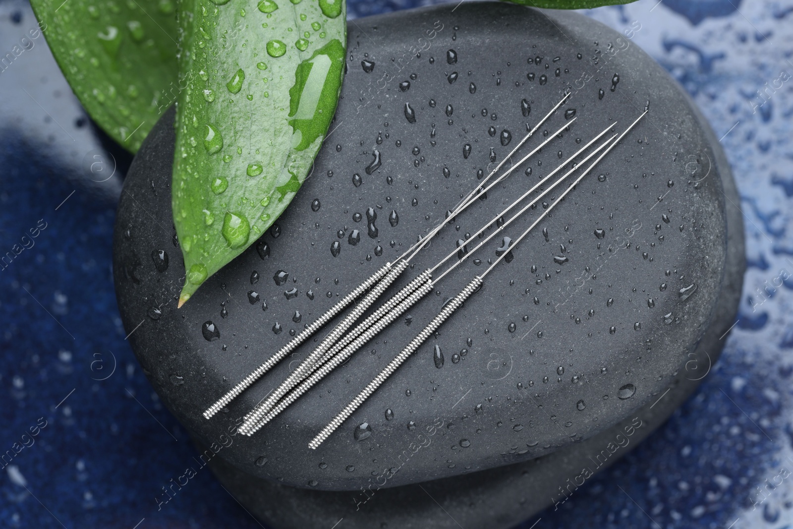 Acupuncture needles, wet spa stones and leaves on blue tray, closeup Photo of Acupuncture needles, wet spa stones and leaves on blue tray, closeup