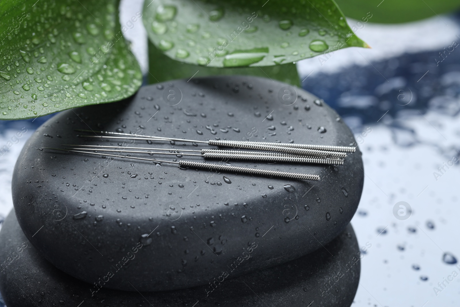Acupuncture needles, wet spa stones and leaves on blue tray, closeup Photo of Acupuncture needles, wet spa stones and leaves on blue tray, closeup