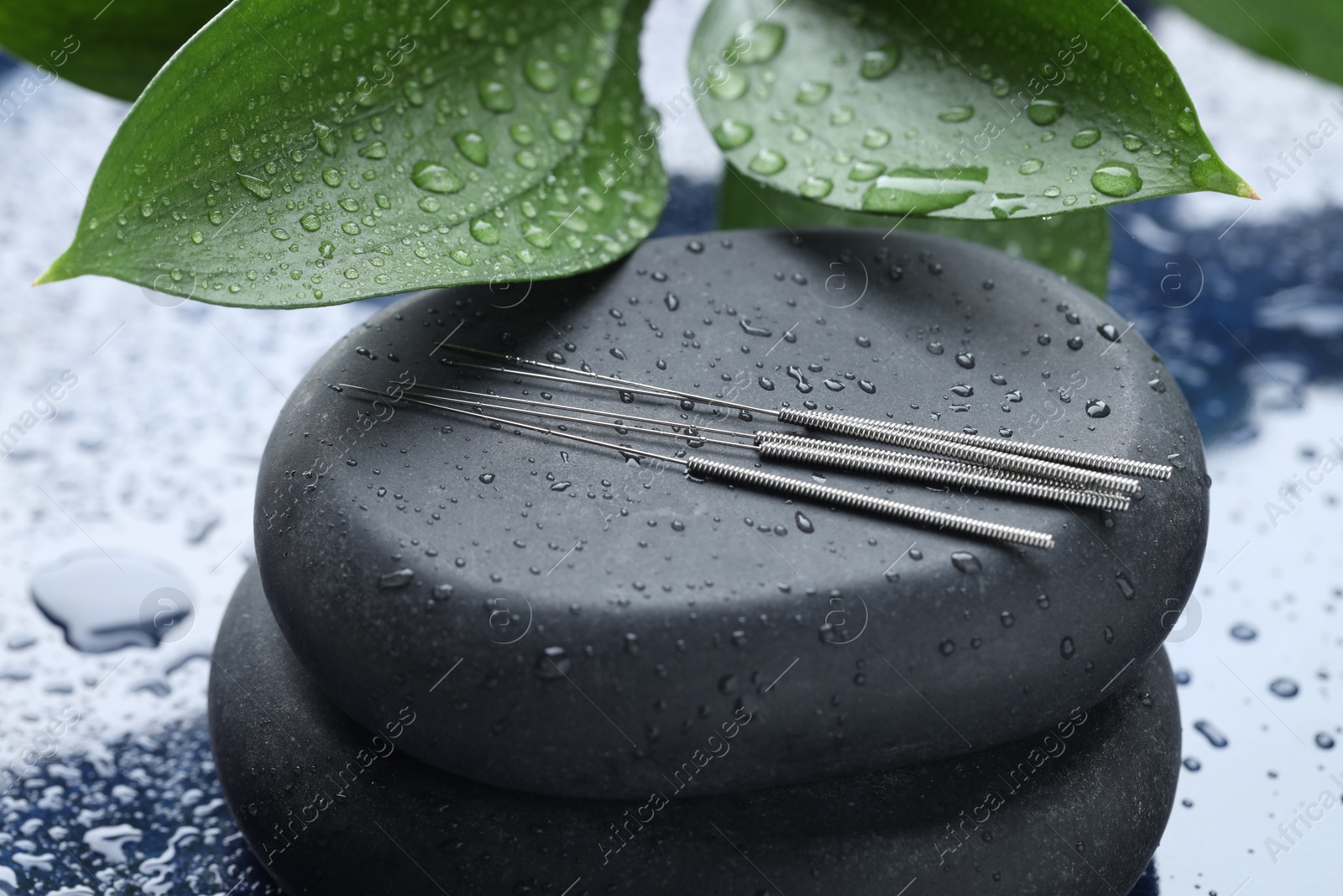 Acupuncture needles, wet spa stones and leaves on blue tray, closeup Photo of Acupuncture needles, wet spa stones and leaves on blue tray, closeup