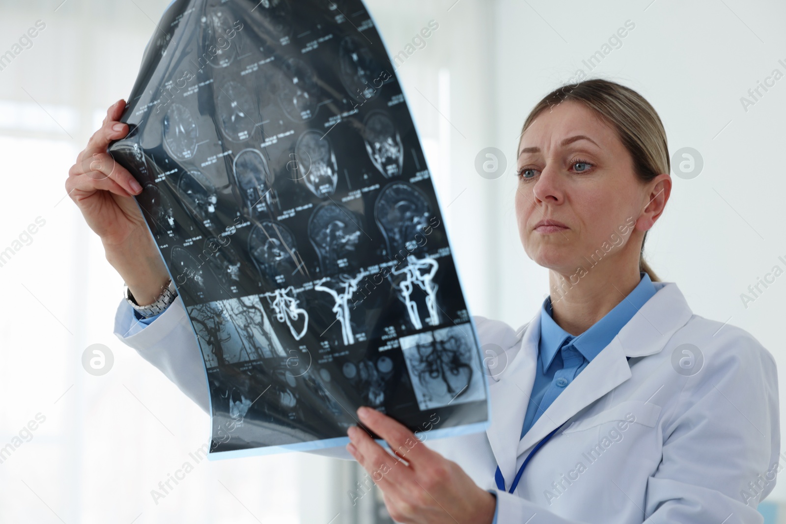 Doctor examining brain MRI scan in hospital Photo of Doctor examining brain MRI scan in hospital