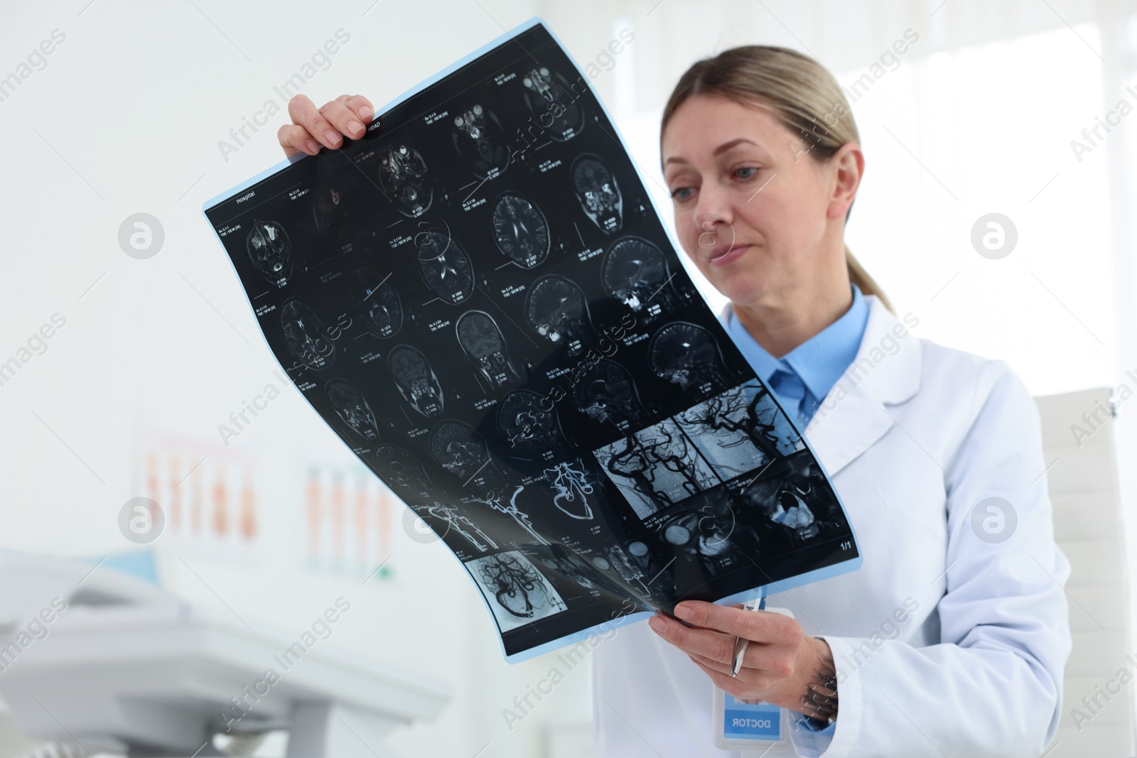 Doctor examining MRI scan in hospital, selective focus Photo of Doctor examining MRI scan in hospital, selective focus