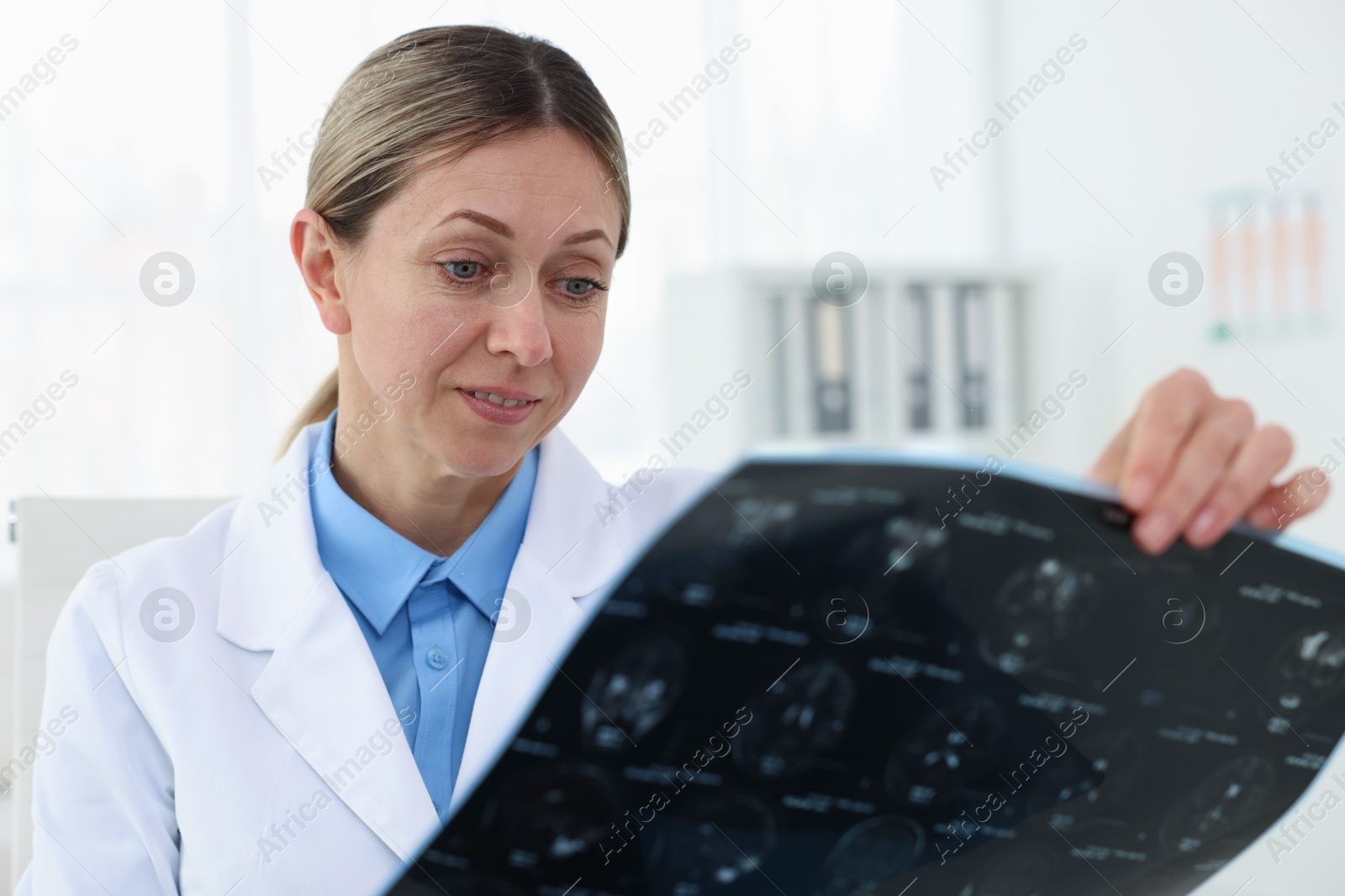 Doctor examining brain MRI scan in hospital Photo of Doctor examining brain MRI scan in hospital