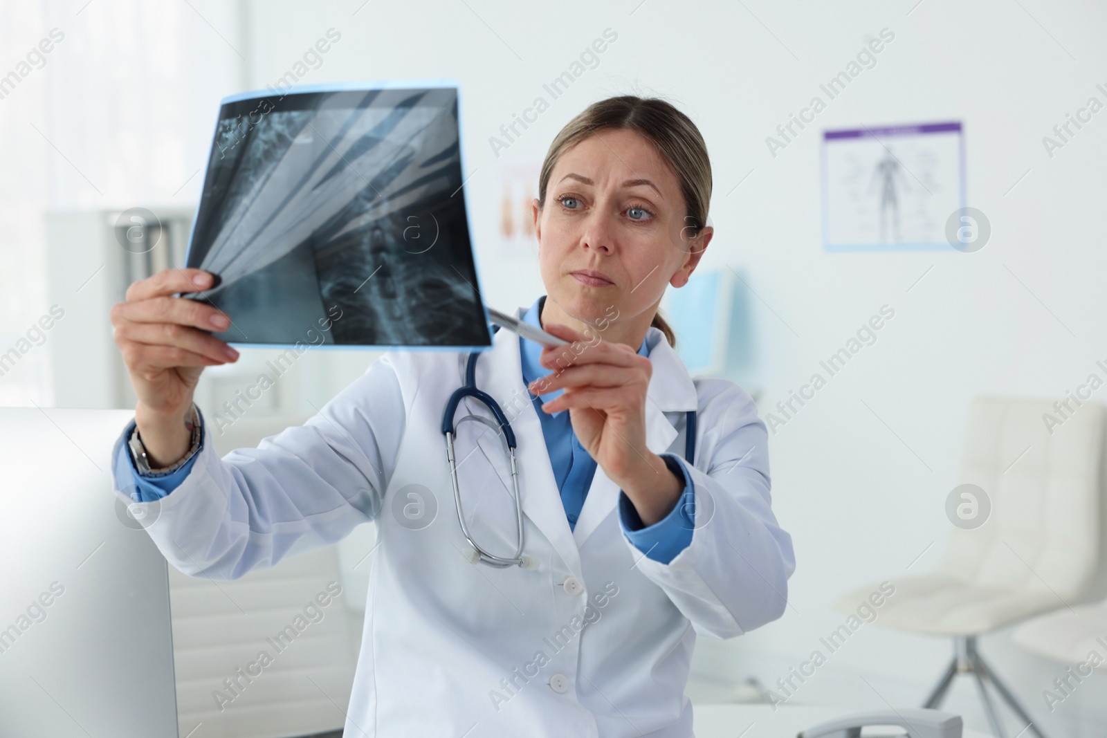 Doctor examining neck MRI scan in hospital Photo of Doctor examining neck MRI scan in hospital