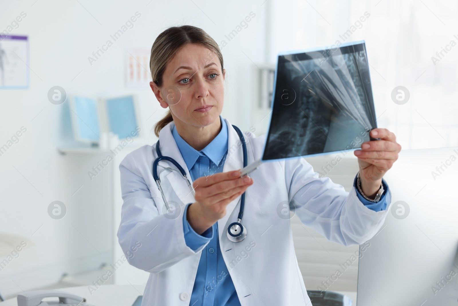 Doctor examining neck MRI scan in hospital Photo of Doctor examining neck MRI scan in hospital