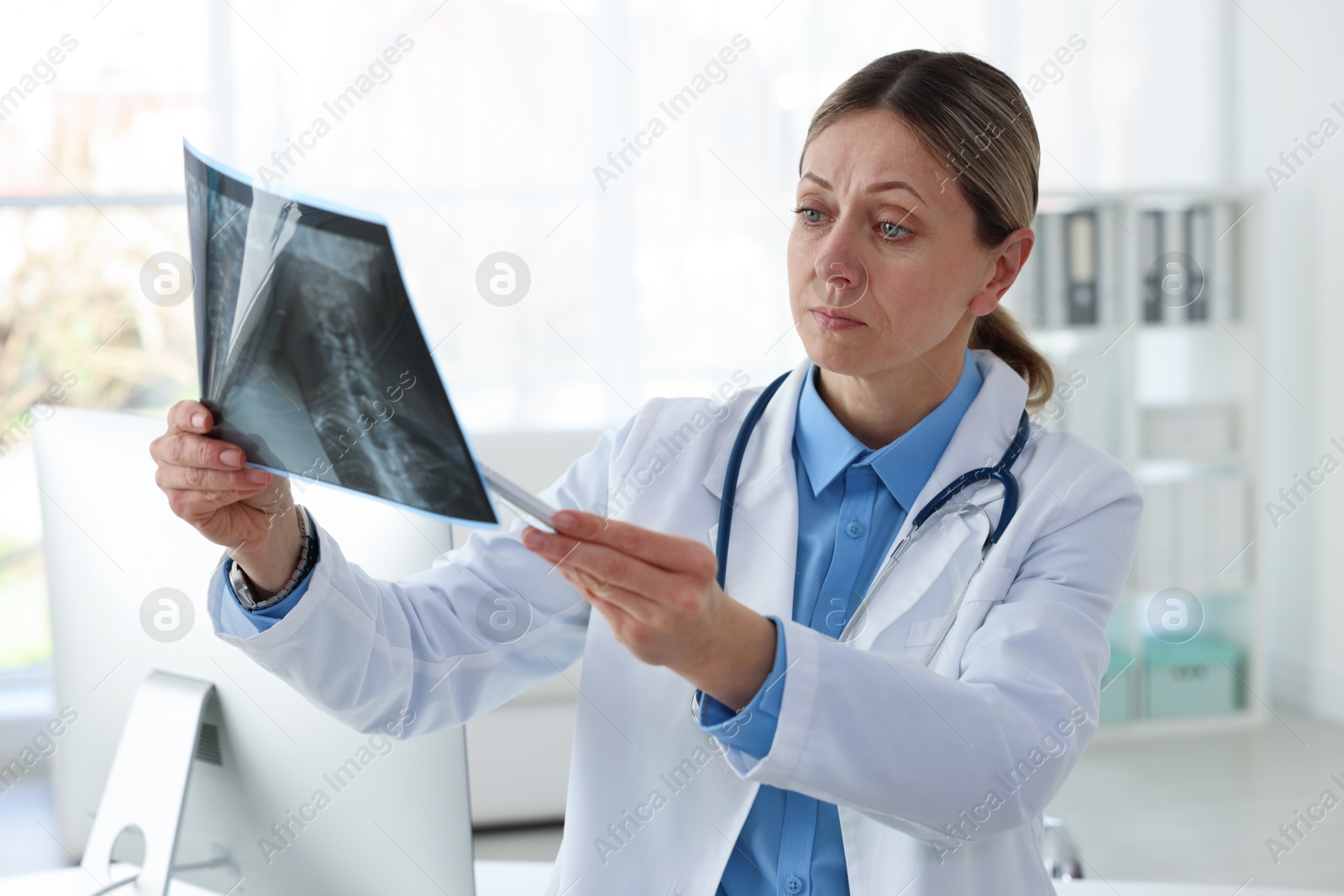 Doctor examining neck MRI scan in hospital Photo of Doctor examining neck MRI scan in hospital