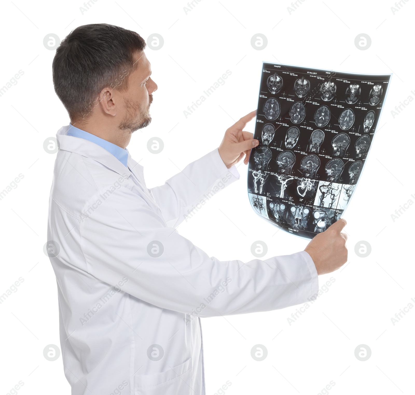 Doctor examining brain MRI scan in clinic on white background Photo of Doctor examining brain MRI scan in clinic on white background