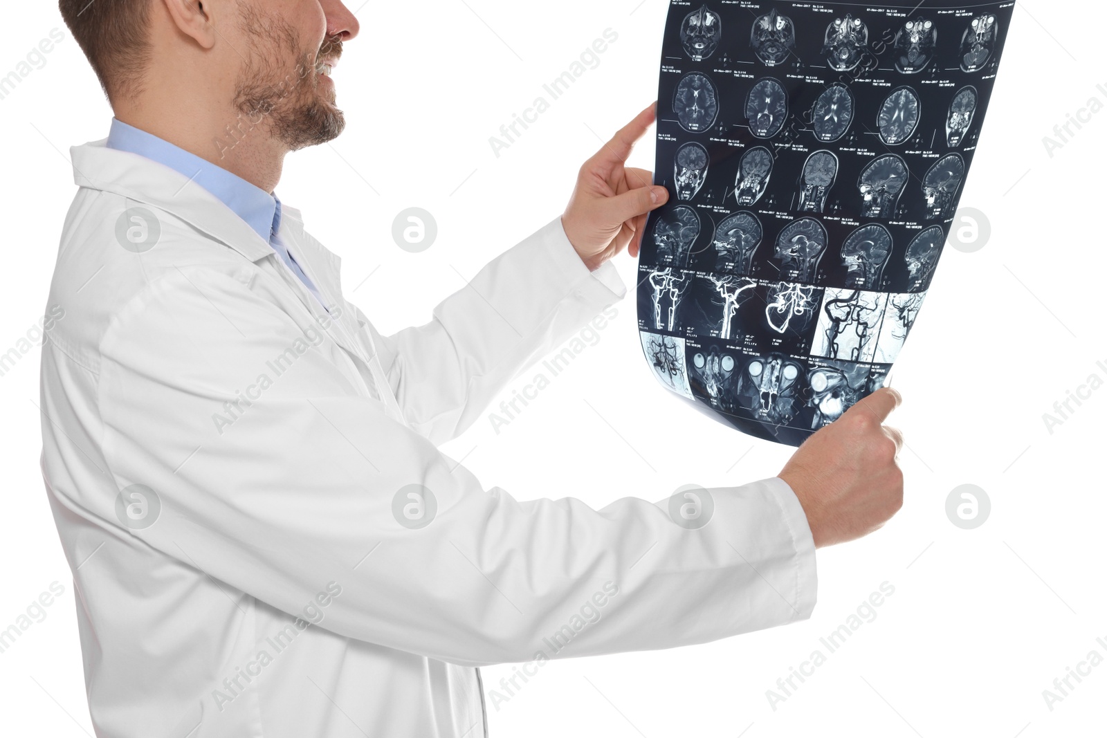 Doctor examining brain MRI scan in clinic on white background, closeup Photo of Doctor examining brain MRI scan in clinic on white background, closeup