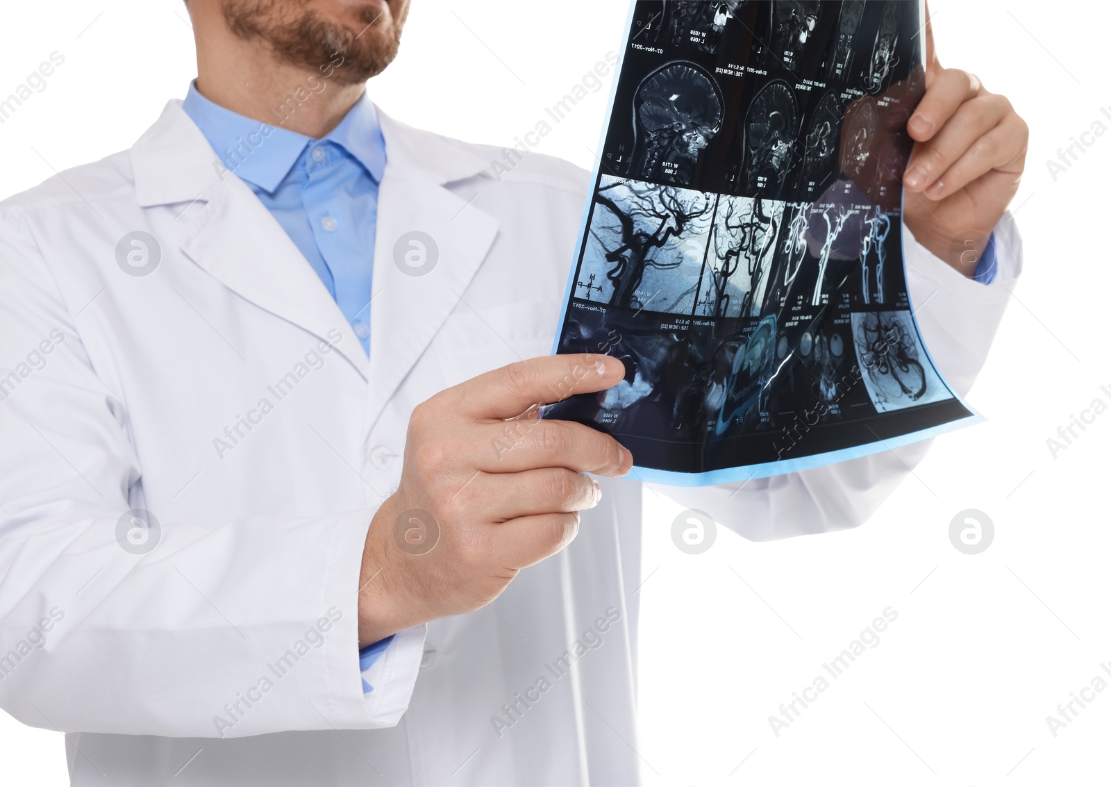 Doctor examining brain MRI scan in clinic on white background, closeup Photo of Doctor examining brain MRI scan in clinic on white background, closeup