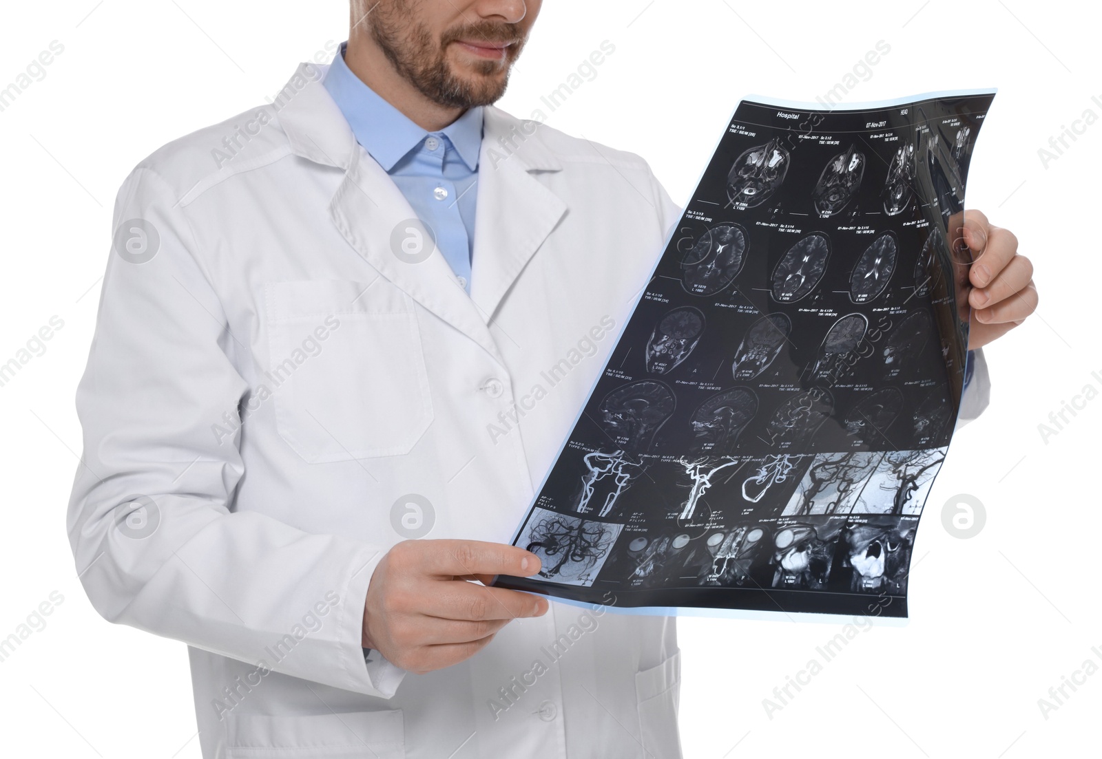 Doctor examining brain MRI scan in clinic on white background, closeup Photo of Doctor examining brain MRI scan in clinic on white background, closeup