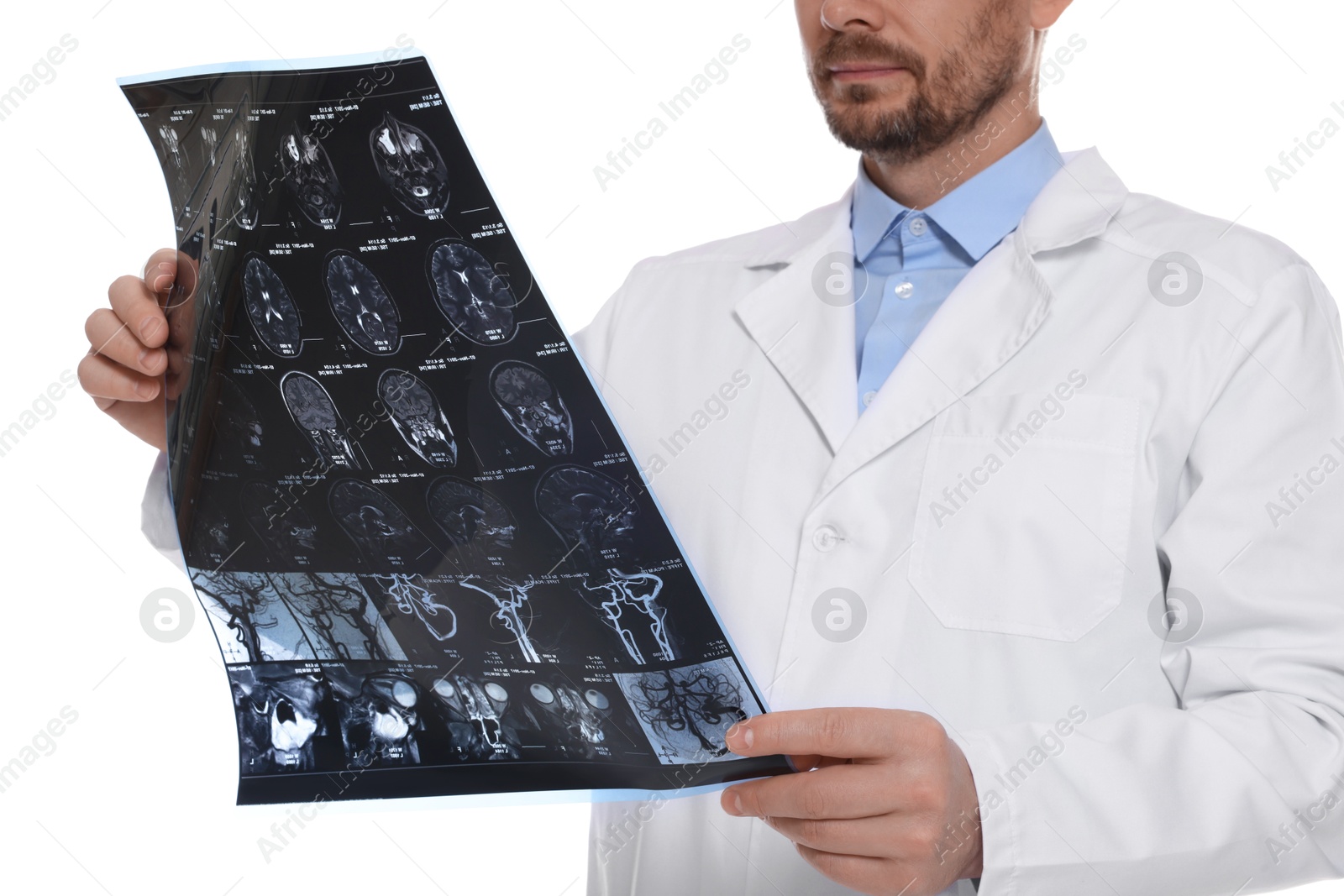 Doctor examining brain MRI scan in clinic on white background, closeup Photo of Doctor examining brain MRI scan in clinic on white background, closeup