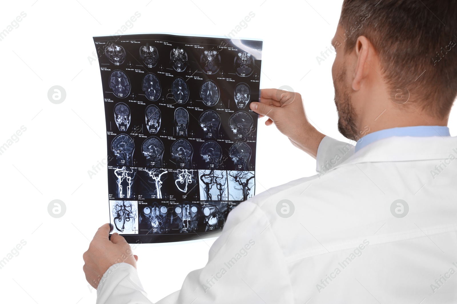 Doctor examining brain MRI scan in clinic on white background Photo of Doctor examining brain MRI scan in clinic on white background