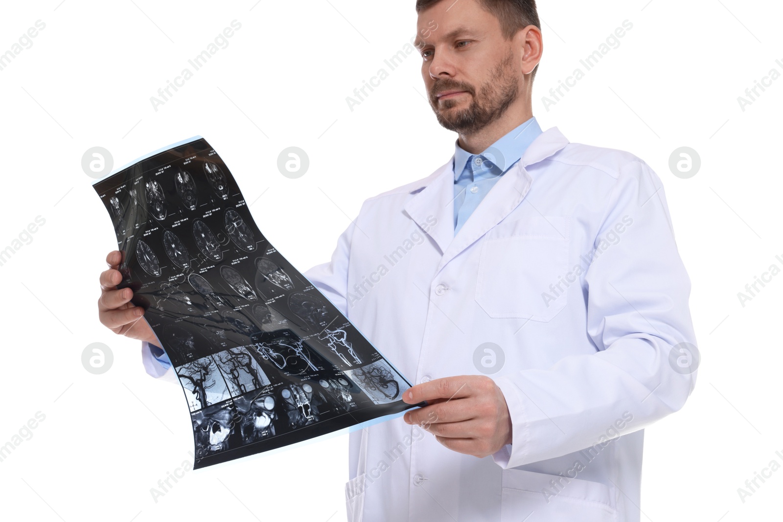 Doctor examining brain MRI scan in clinic on white background, low angle view Photo of Doctor examining brain MRI scan in clinic on white background, low angle view