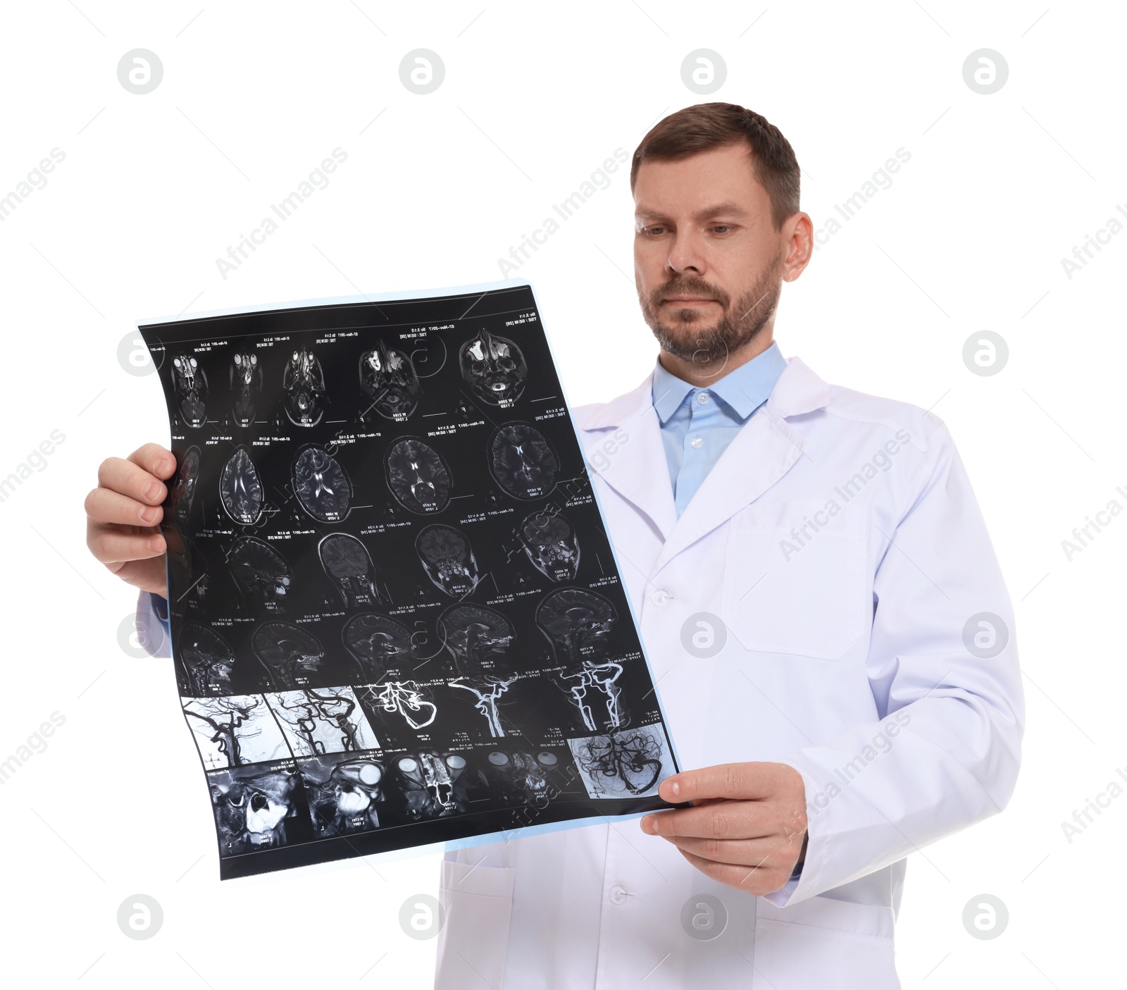 Doctor examining brain MRI scan in clinic on white background Photo of Doctor examining brain MRI scan in clinic on white background