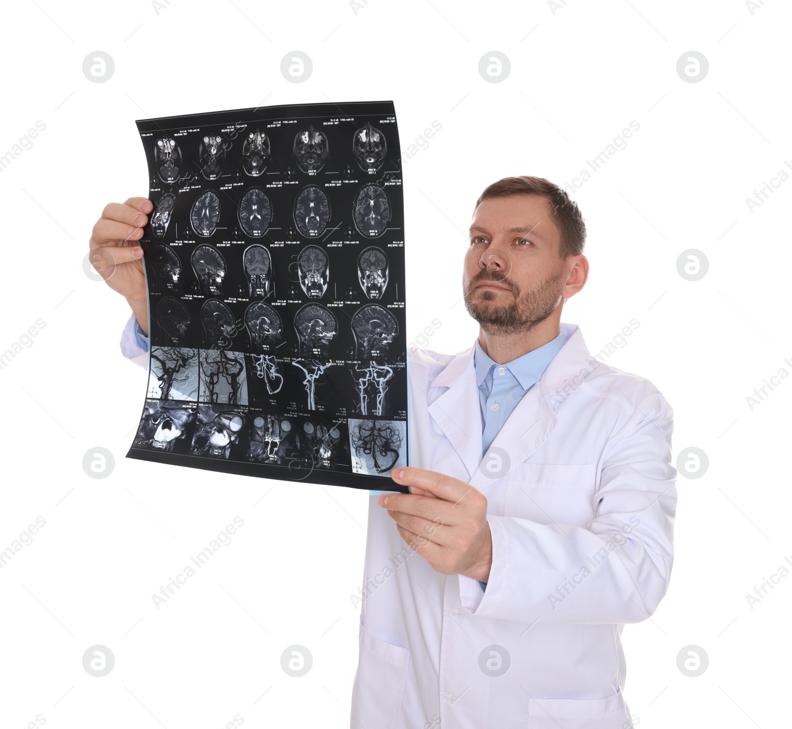 Doctor examining brain MRI scan in clinic on white background Photo of Doctor examining brain MRI scan in clinic on white background