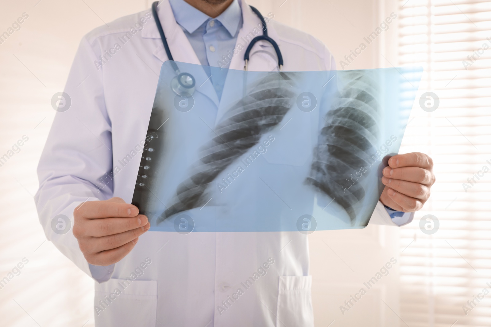 Doctor examining lung MRI scan in clinic, closeup Photo of Doctor examining lung MRI scan in clinic, closeup