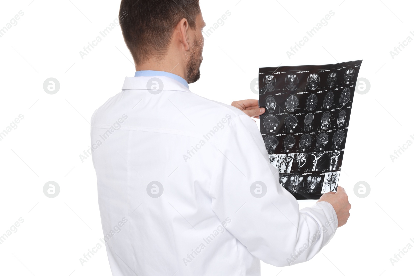 Doctor examining brain MRI scan in clinic on white background Photo of Doctor examining brain MRI scan in clinic on white background