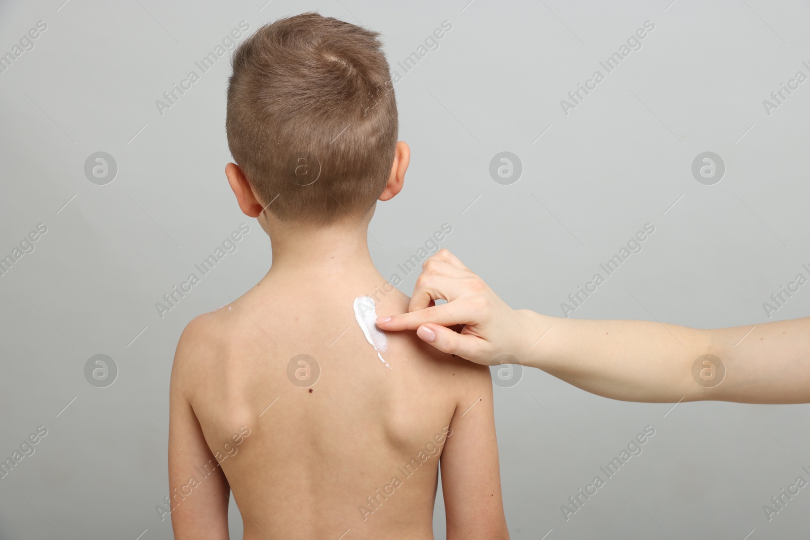 Mother applying sun protection cream onto her son's skin on light grey background, closeup Photo of Mother applying sun protection cream onto her son's skin on light grey background, closeup