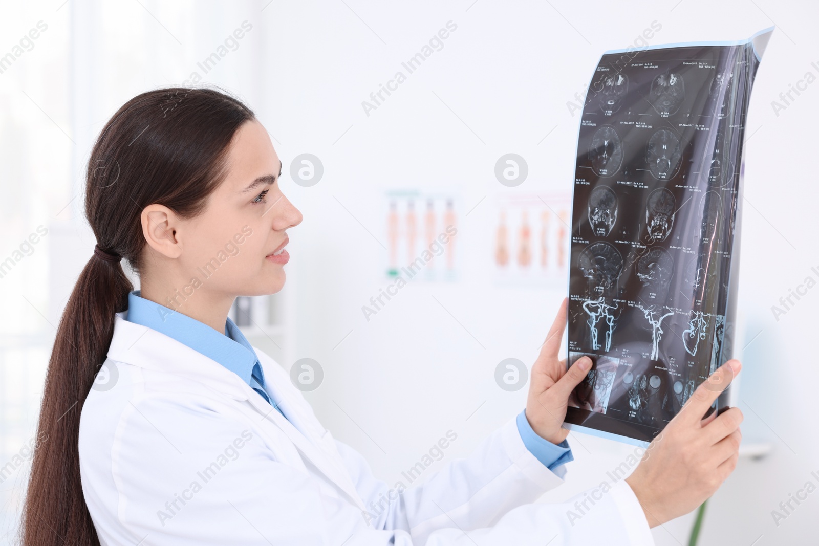 Doctor examining brain MRI scan in hospital Photo of Doctor examining brain MRI scan in hospital