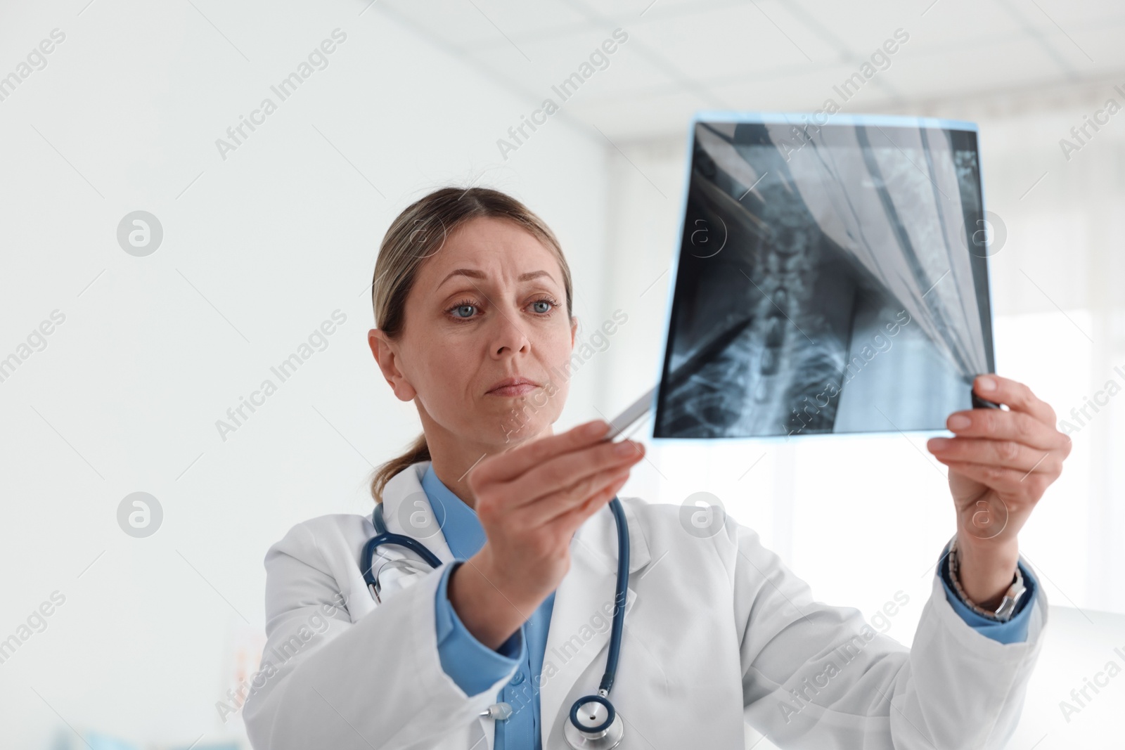 Doctor examining neck MRI scan in hospital Photo of Doctor examining neck MRI scan in hospital