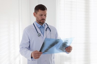 Photo of Doctor examining lung MRI scan in clinic