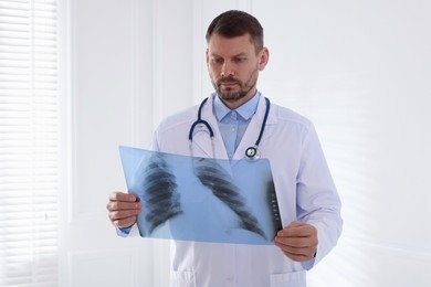 Photo of Doctor examining lung MRI scan in clinic