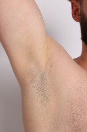 Photo of Man after hair removal procedure on light background, closeup