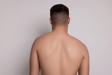 Photo of Man before scoliosis treatment on light background, back view