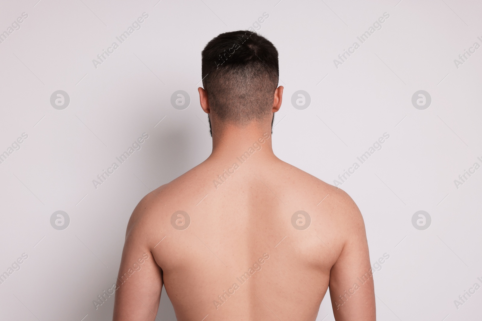 Man after scoliosis treatment on light background, back view Photo of Man after scoliosis treatment on light background, back view
