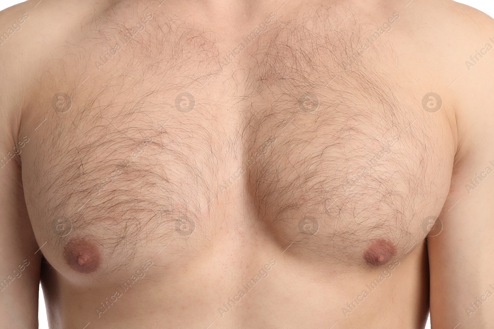 Young man with hairy chest, closeup. Epilation procedure Photo of Young man with hairy chest, closeup. Epilation procedure